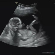 임신 15-17주 :: 입덧약끊기 / 하이베베 / 경주겹벚꽃 / 붕어빵부녀
