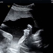 임신 18-20주 :: 임산부수박 / 장미축제 / 선암호수공원