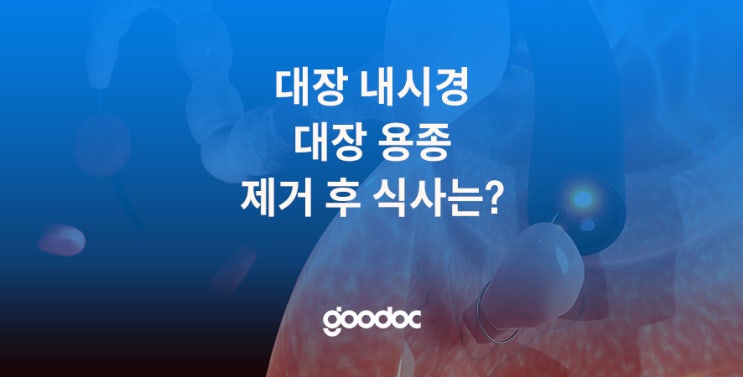 대장 내시경으로 대장 용종 제거 후 음주 가능할까? 용종 선종 원인과 크기, 대장암 예방 필요 : 네이버 블로그