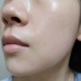 피부일기 : 재생레이저로 피부복구 시작(feat.토르리프팅&플라즈마젯 조합으로 다시 건강해지기)