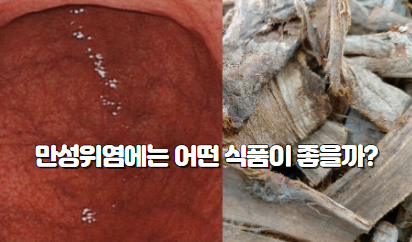 만성 위축성위염 치료는 어떻게 하면 좋을까? : 네이버 블로그