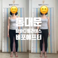 동대문필라테스 탐바디필라테스 비포에프터