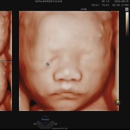 [임신27주] 눈,코,입🐯 입체초음파를 보다💛👶🏻❤️