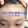 7살 아이 이마 세로로 또 찢어짐 W병원 봉합수술