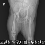 고관절 탈구 교정, 대퇴골두 절단술