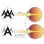 소중한 우리 눈! 시력 문제에는 어떤 것들이 있을까요?
