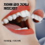 치아에 금이 가거나 깨졌다면? : 치아파절, 치아크랙