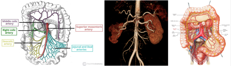 상장간막동맥(SMA : Superior Mesentric artery)의 분지혈관명칭 및 해부학적이해 : 네이버 블로그