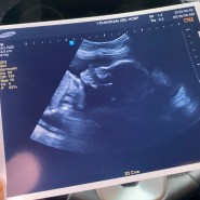 [임신 22주~24주] 임당검사, 임당 통과, 드디어 7개월 입성, 환도선다 시작