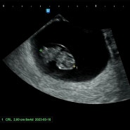 임신준비부터 임신 12주차 증상과 기록!