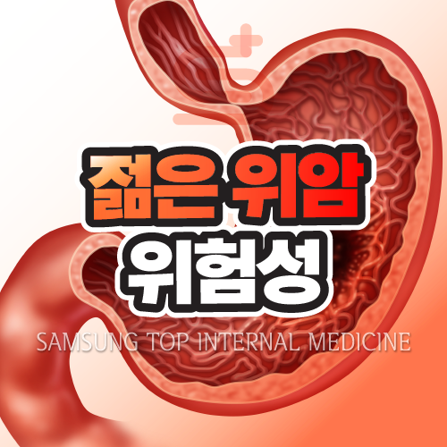 20대 위암환자 젊은 위암의 초기증상과 완치율 : 네이버 블로그