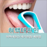 혀 백태 원인 제거방법과 예방법 알아보기