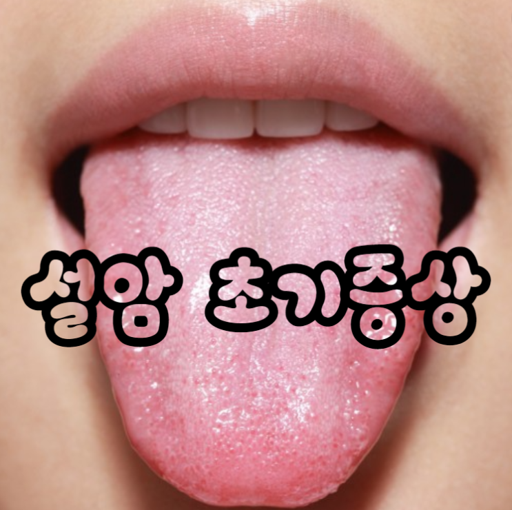 설암 초기증상 6가지 원인 치료 : 네이버 블로그
