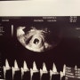마미톡 임신 초기 증상 임신 2-3개월 7주 9주 12주 2023년임산부 정부 혜택