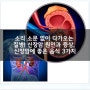 소리 소문 없이 다가오는 질병! 신장암 원인과 증상, 신장암에 좋은 음식 3가지