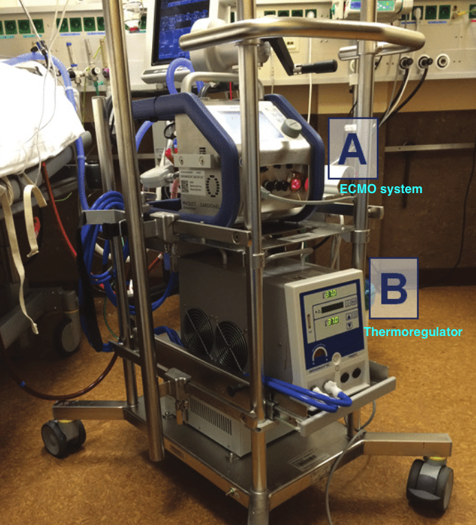 저기요, '에크모'가 뭐에요? ECMO? Do you know what it is? (ECMO series 1편 - 개념 잡기 ...