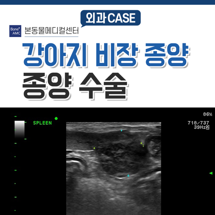 건강검진을 했는데 비장에 종양이 있어요. 비장 종양 수술. : 네이버 블로그