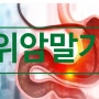 위암 말기에 항암과 병행하면 도움이 많이 될 면역치료가 어떤 것이 있을 까요?