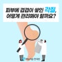 수원건선 피부에 쌓인 각질관리방법은?