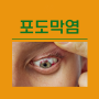 눈병 포도막염 증상 원인 치료 홍채염 한쪽 눈 충혈 핏줄터짐 실핏줄 염증 질환 출혈 날파리증 눈에벌레 아지랑이 시각장애 시야흐림