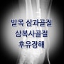 발목 삼복사골절 후유장해 청구 가능성 실제사례