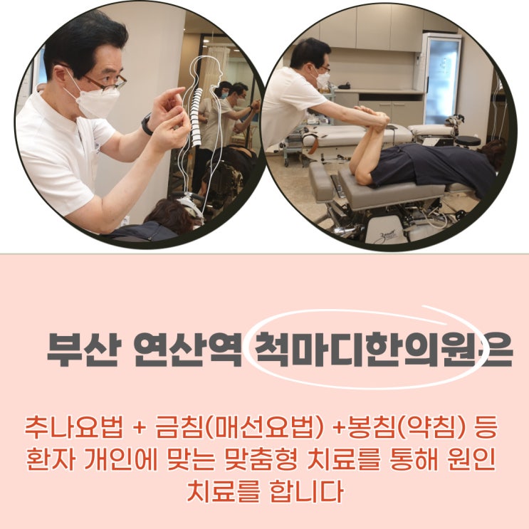 [ 통증탈출!] 2022 새해에도 금침 #매선요법입니다 : 네이버 블로그