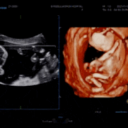 임신 16주 - 임신19주 2차기형아검사, 태아성별확정, 첫태동?