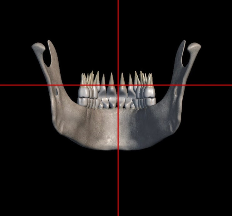 Mandible PA / Axiolateral : 네이버 블로그