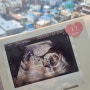[임신기록] 버들이와 여섯째 만남, 임신 17주