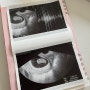 임신8주 : 정기검진, 임신8주증상, 태몽 사과꿈