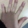 손가락 관절 통증이 느껴진다면 손가락 보호대를 착용해보자!