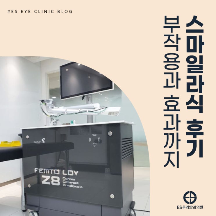 스마일라식후기 부작용부터 효과까지 파헤치기 : 네이버 블로그