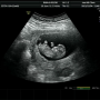 [임신 기록]임신 4주차~12주차 증상 기록/심장소리 듣다/1차 기형아 검사/태아 보험/조리원 예약 완료