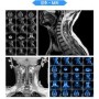 척추(허리) MRI 3월부터 건강보험 급여화 시행