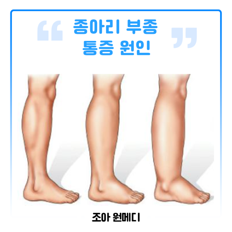 종아리 부종 통증 원인 무엇일까? : 네이버 블로그