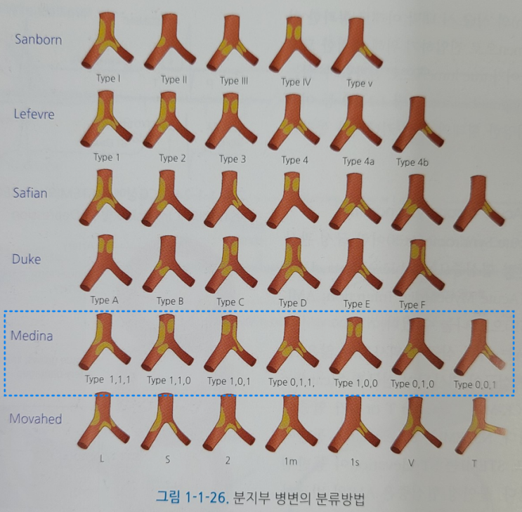 Medina classification system_심혈관중재매뉴얼_금천구심장내과_혈관중재센터_중재시술인증의 : 네이버 블로그