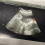 임신 29주~31주차 증상- 배땡김,배콕콕 8개월차 임산부의 일상😆