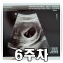 [6주차]행신 연세그린맘스여성의원 아기 심장소리 들었어요!