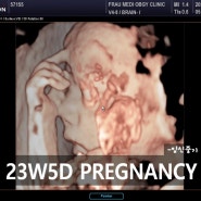 임신중기Ⅱ (21주~27주) 증상 및 병원 검사 기록, 임신 중기를 보내면서 해야할 일들