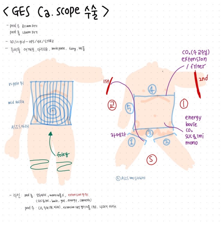[GES] cancer scope , small bowel scope : 네이버 블로그