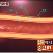 급사는 활성 산소가 원인. 제어하는 방법은 간단해요. 비타민C의 역할