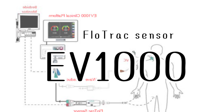 심장flow의 parameter. EV1000 - FloTrac sensor : 네이버 블로그