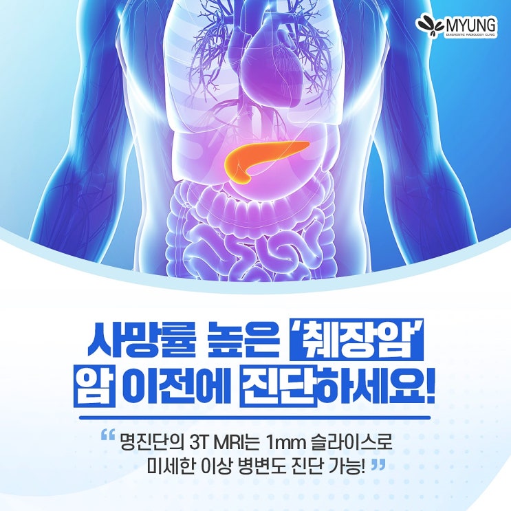 췌장암 조기 진단 위해서는 복부MRI(엠알아이) 검사 : 네이버 블로그