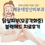 해운대 장산 피부과 닭살피부(모공각화증)치료, 블랙헤드 더마아크네, 코레지에그 리프팅