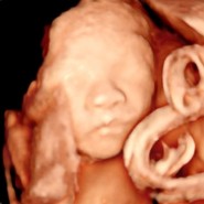 임신 정밀 초음파 “ 두근두근 “ 드디어 우리 둘째 아들 초음파 공개