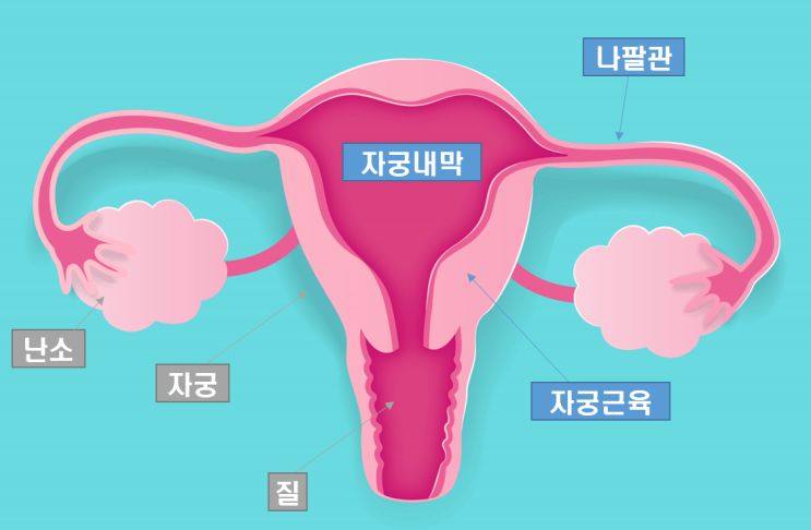 생리통 심할때? 부정출혈 원인? 이름은 비슷하지만, 전혀 달라요! (자궁내막증 Vs 자궁내막증식증) : 네이버 블로그 생리통 심할때? 부정출혈 원인? 이름은 비슷하지만, 전혀 달라요! (자궁내막증 Vs 자궁내막증식증) : 네이버 블로그