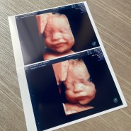[임신 29주] 29주 셀프만삭사진, 29주 입체초음파, 육아용품 준비는 대존잼, 임산부 독감주사