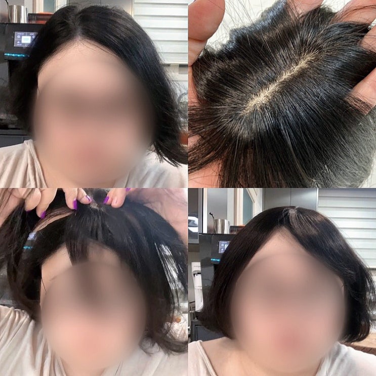 여자정수리가발 인모 우주날다 앞머리 가발 리얼헤어 볼륨감 정수리 탈모 흰머리 커버 부분가발 : 네이버 블로그