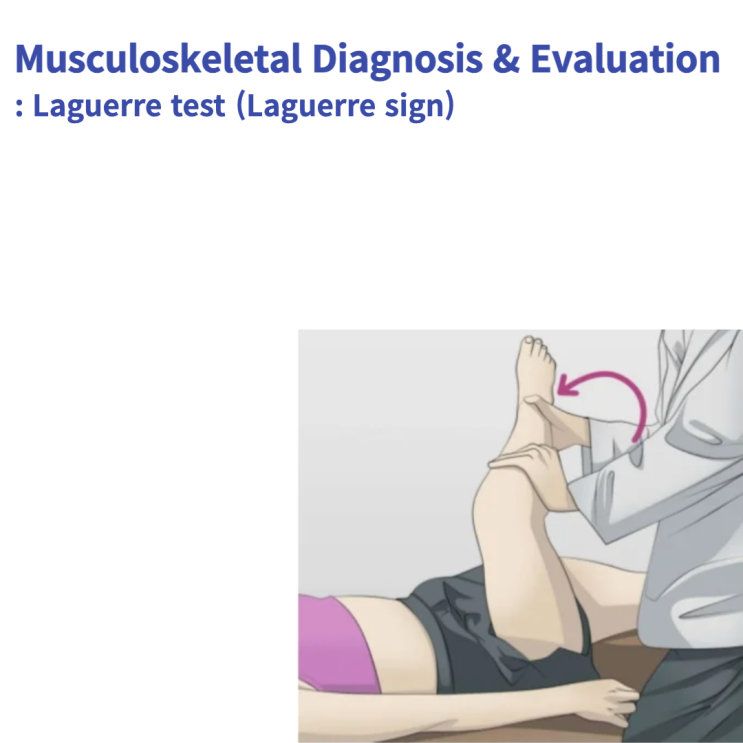 Laguerre test (Laguerre sign) : 라그에르 징후 - 엉치엉덩관절 손상 평가 : 네이버 블로그