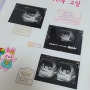 [2022.05.19 / 임신10주2일] 임신10주 초음파